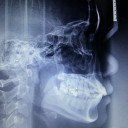 ตัวดำตาตี่