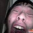 แขนเป็นอะไรอ่ะ? อ๋อ แขนเป็นฟอ