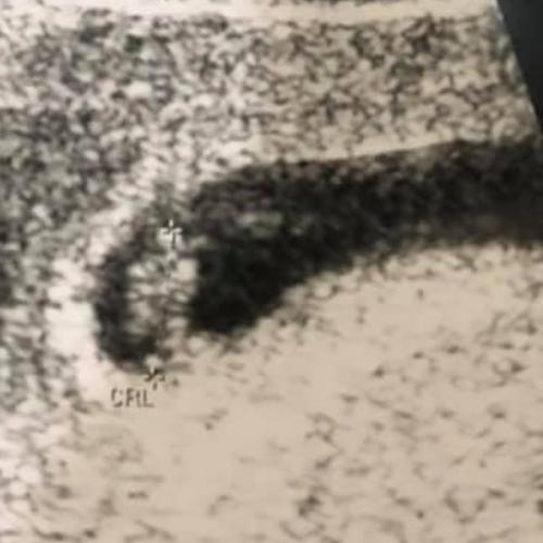 สมาชิกหมายเลข 5660742