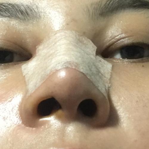 สมาชิกหมายเลข 5687278