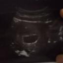 สมาชิกหมายเลข 4122587