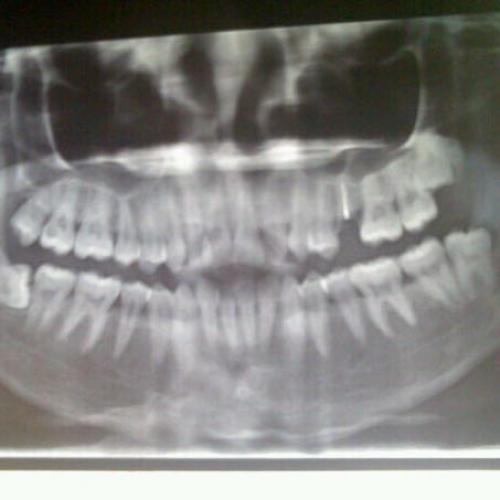 your smile make me happy