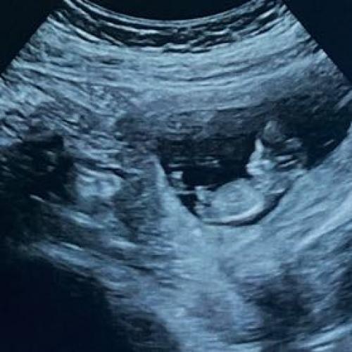 สมาชิกหมายเลข 2743451