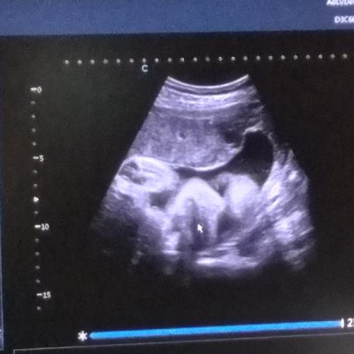 สมาชิกหมายเลข 6685491